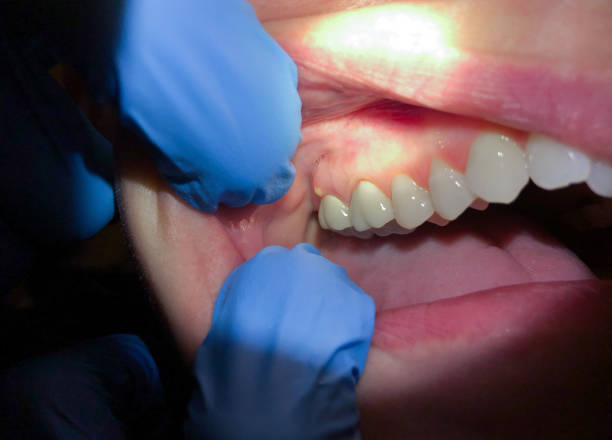 Best Urgent Tooth Repair  in Hasbrouck Heights, NJ
